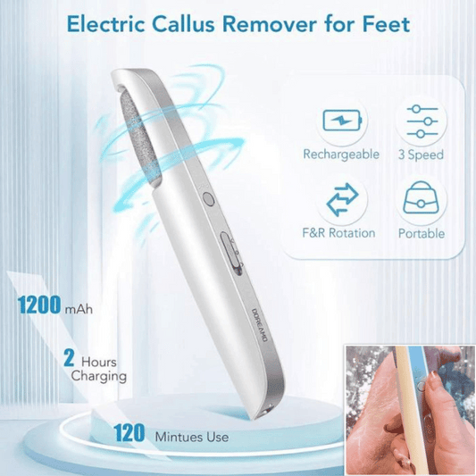 📢📢Enjoy 40%discount today!⏰Portable Electric Feet Callus Remover