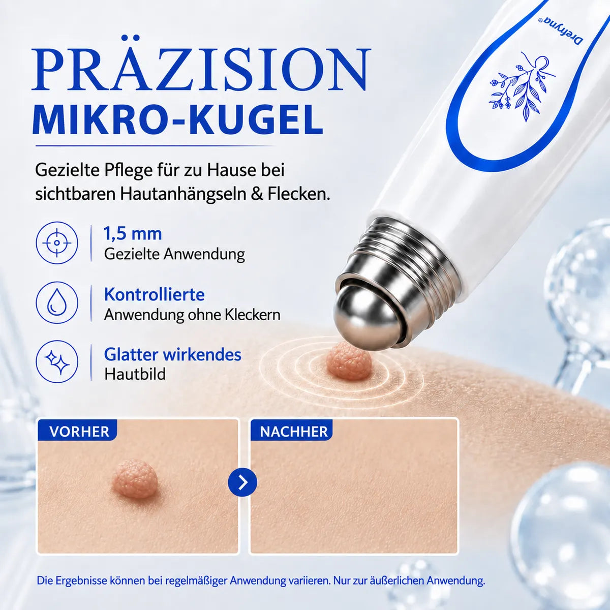 💧𝟕-𝐓𝐚𝐠𝐞-𝐄𝐧𝐭𝐟𝐞𝐫𝐧𝐞𝐫 𝐟ü𝐫 𝐇𝐚𝐮𝐭𝐚𝐧𝐡ä𝐧𝐠𝐬𝐞𝐥 & 𝐇𝐚𝐮𝐭𝐟𝐥𝐞𝐜𝐤𝐞𝐧 – Schmerzfreier & narbenfreier Roll-on-Stift zur gezielten Entfernung von Hautunregelmäßigkeiten