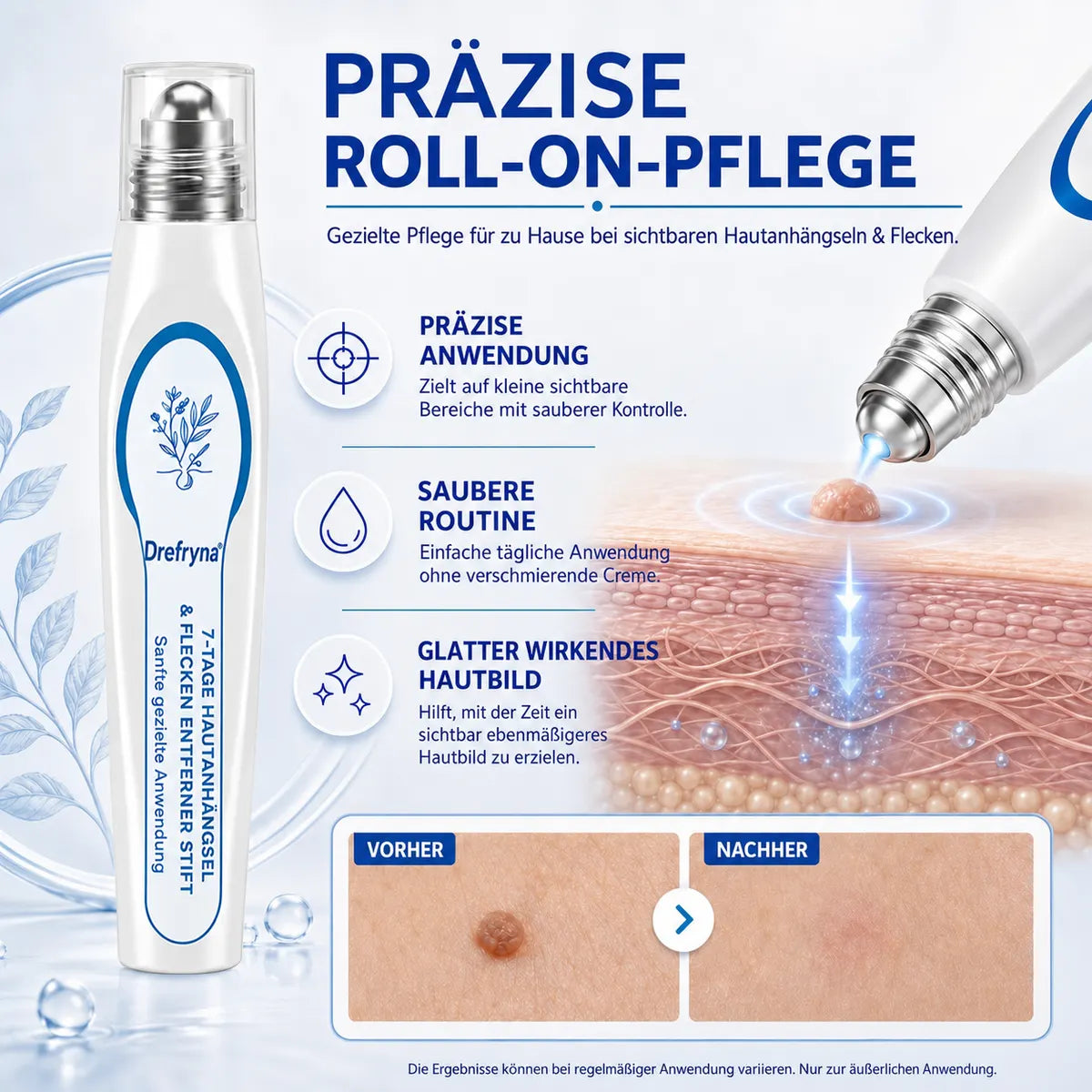 💧𝟕-𝐓𝐚𝐠𝐞-𝐄𝐧𝐭𝐟𝐞𝐫𝐧𝐞𝐫 𝐟ü𝐫 𝐇𝐚𝐮𝐭𝐚𝐧𝐡ä𝐧𝐠𝐬𝐞𝐥 & 𝐇𝐚𝐮𝐭𝐟𝐥𝐞𝐜𝐤𝐞𝐧 – Schmerzfreier & narbenfreier Roll-on-Stift zur gezielten Entfernung von Hautunregelmäßigkeiten