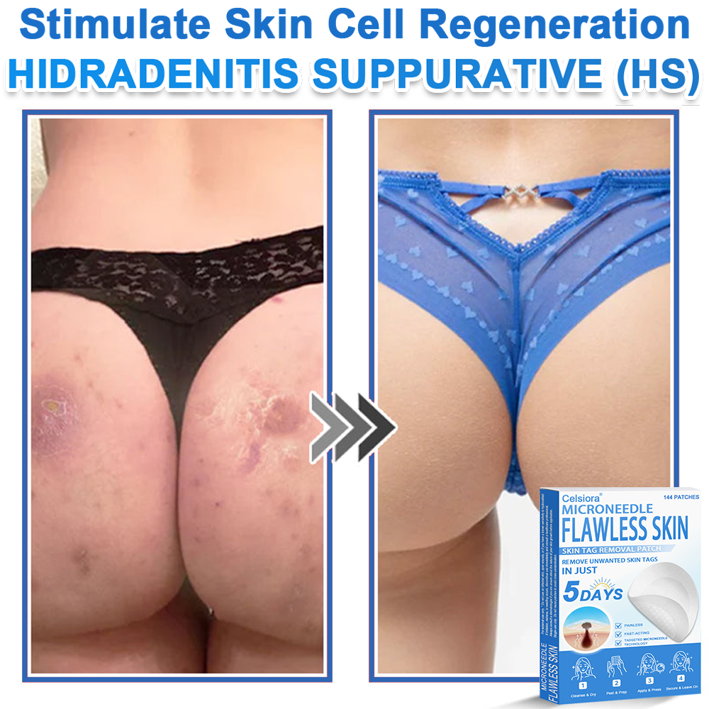 📌 Celsiora® 2-in-1 Microneedle & Hydrocolloid Patch | Raised Moles,Acne,  Flat Warts & Skin Tags Remover | Improves Wrinkles, Scars & Blemishes | Invisible Star Pimple Patches for Face & Body