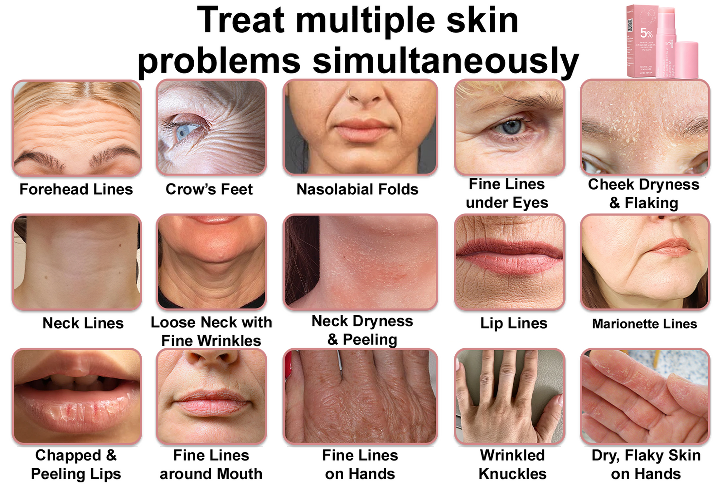 🥳60% OFF | Today Only!🥳💕PDRN Pink Collagen Volume Multi Balm | All In One Volufiline, PDRN, NAD Stick for Youthful-Looking