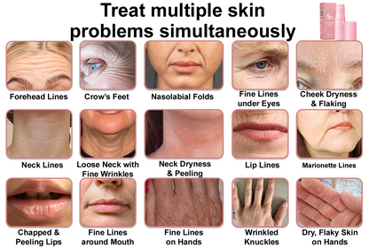 🥳60% OFF | Today Only!🥳💕PDRN Pink Collagen Volume Multi Balm | All In One Volufiline, PDRN, NAD Stick for Youthful-Looking