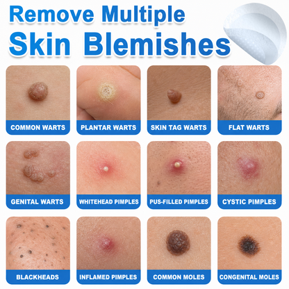 💚 Celsiora® 2-in-1 Microneedle & Hydrocolloid Patch | Raised Moles,Acne,  Flat Warts & Skin Tags Remover | Improves Wrinkles, Scars & Blemishes | Invisible Star Pimple Patches for Face & Body
