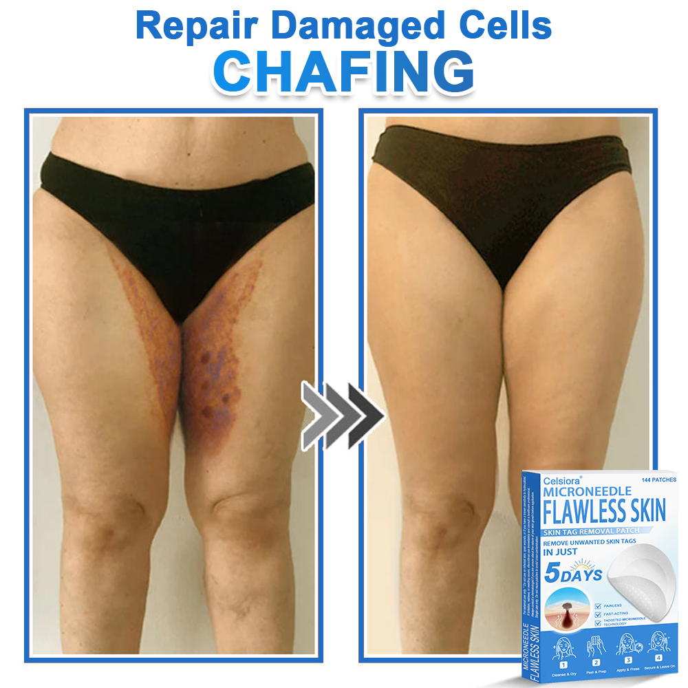 📌 Celsiora® 2-in-1 Microneedle & Hydrocolloid Patch | Raised Moles,Acne,  Flat Warts & Skin Tags Remover | Improves Wrinkles, Scars & Blemishes | Invisible Star Pimple Patches for Face & Body