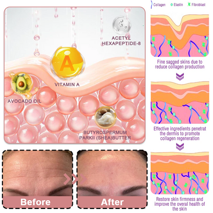 🥳60% OFF | Today Only!🥳💕PDRN Pink Collagen Volume Multi Balm | All In One Volufiline, PDRN, NAD Stick for Youthful-Looking
