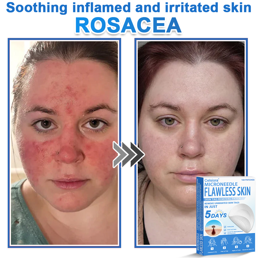 📌 Celsiora® 2-in-1 Microneedle & Hydrocolloid Patch | Raised Moles,Acne,  Flat Warts & Skin Tags Remover | Improves Wrinkles, Scars & Blemishes | Invisible Star Pimple Patches for Face & Body