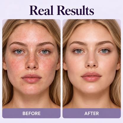 🥳💞50K+ SOLD!⏳ Last day to save 63%🔥🔥🔥Color Changing Foundation Stick✨✨✨