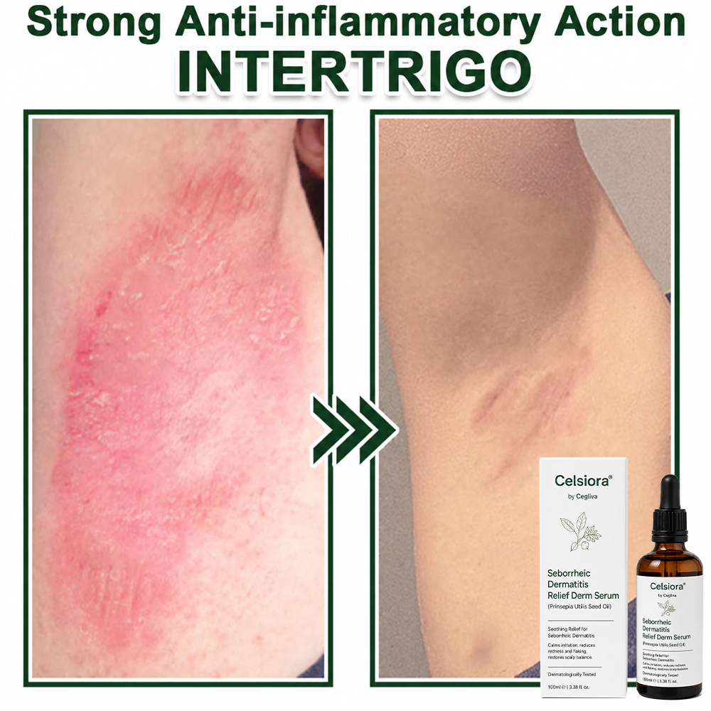 🍃Celsiora® Seborrheic Dermatitis Relief Derm Serum