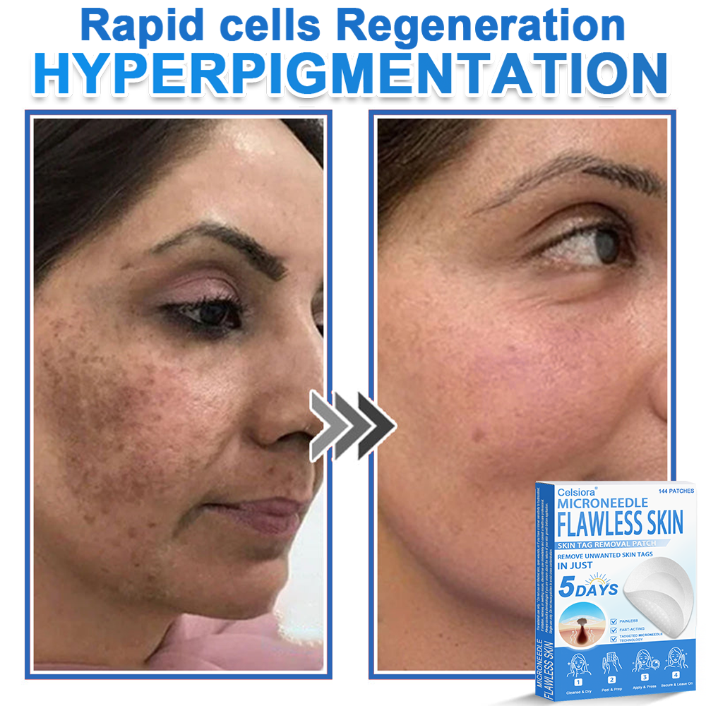 📌 Celsiora® 2-in-1 Microneedle & Hydrocolloid Patch | Raised Moles,Acne,  Flat Warts & Skin Tags Remover | Improves Wrinkles, Scars & Blemishes | Invisible Star Pimple Patches for Face & Body