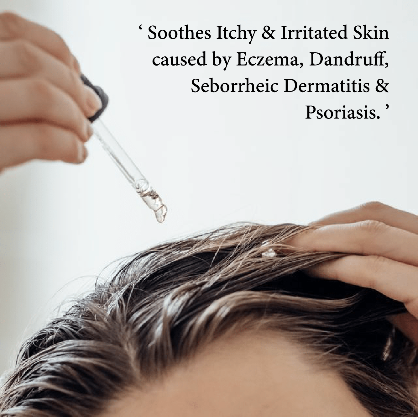 🍃Celsiora® Seborrheic Dermatitis Relief Derm Serum