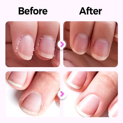 💜Half price for a limited time💜2026 New Upgraded 3-in-1 Nail Care Pen💅