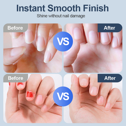 💥LAST DAY SALE 50% OFF💥 Universal Automatic Fingernail Grinder for Adults and Children-Remifa®